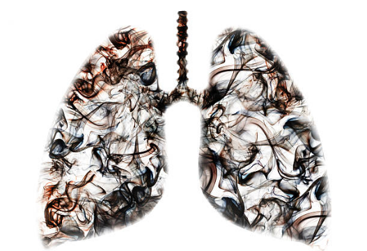 Phổi bị nhiễm độc là nguyên nhân trực tiếp dẫn đến COPD