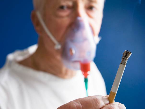 Hút thuốc lá -  nguyên nhân hàng đầu gây bệnh phổi tắc nghẽn mãn tính COPD