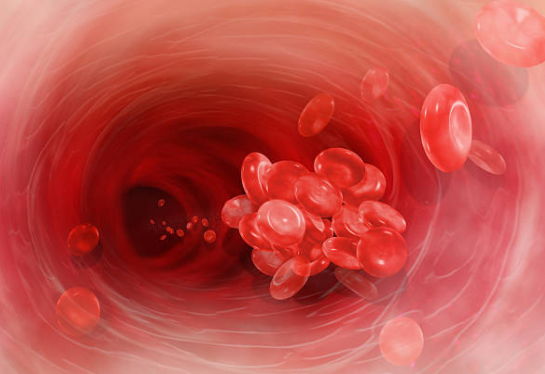 Biến chứng đa hồng cầu làm tăng nguy cơ huyết khối và tắc mạch