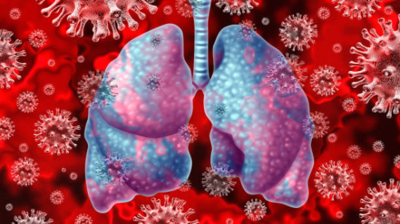Phổi bị nhiễm độc là nguyên nhân trực tiếp của bệnh COPD