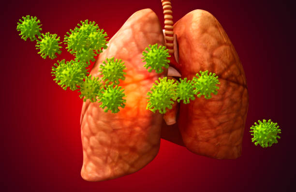 Ho kéo dài có đờm là dấu hiệu của tình trạng phổi bị nhiễm độc