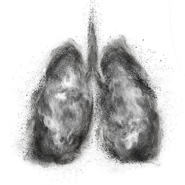  Phổi bị nhiễm độc là nguyên nhân gốc gây ung thư phổi