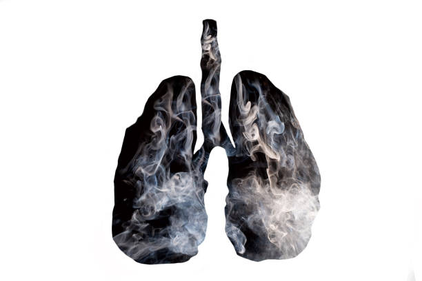 Khói thuốc lá gây tổn thương phổi