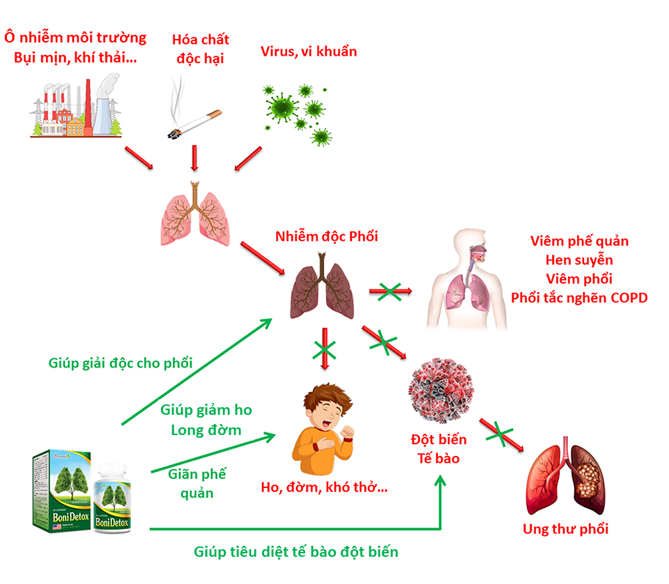  BoniDetox giúp phòng ngừa ung thư phổi theo nhiều cơ chế khác nhau