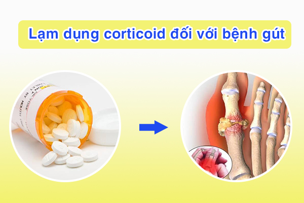Nhiều người bệnh gút đang lạm dụng corticoid