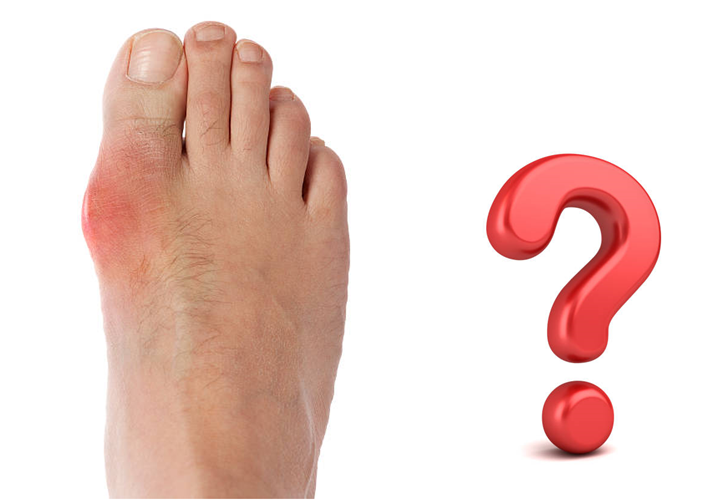 Ngón chân cái bị sưng nhức là bệnh gì?