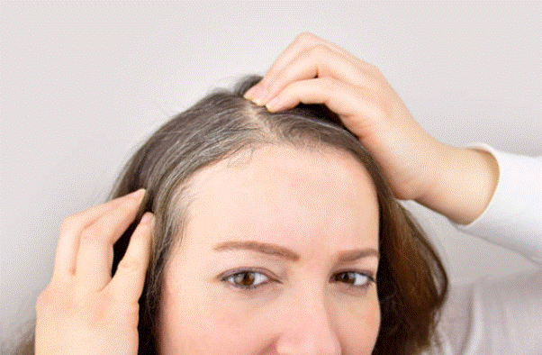 Đậu đen được dùng nhiều trong dân gian để cải thiện bạc tóc