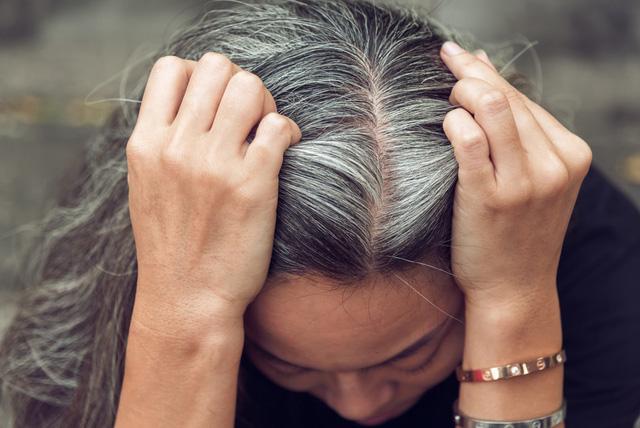 Cách chữa bạc tóc không cần nhuộm?