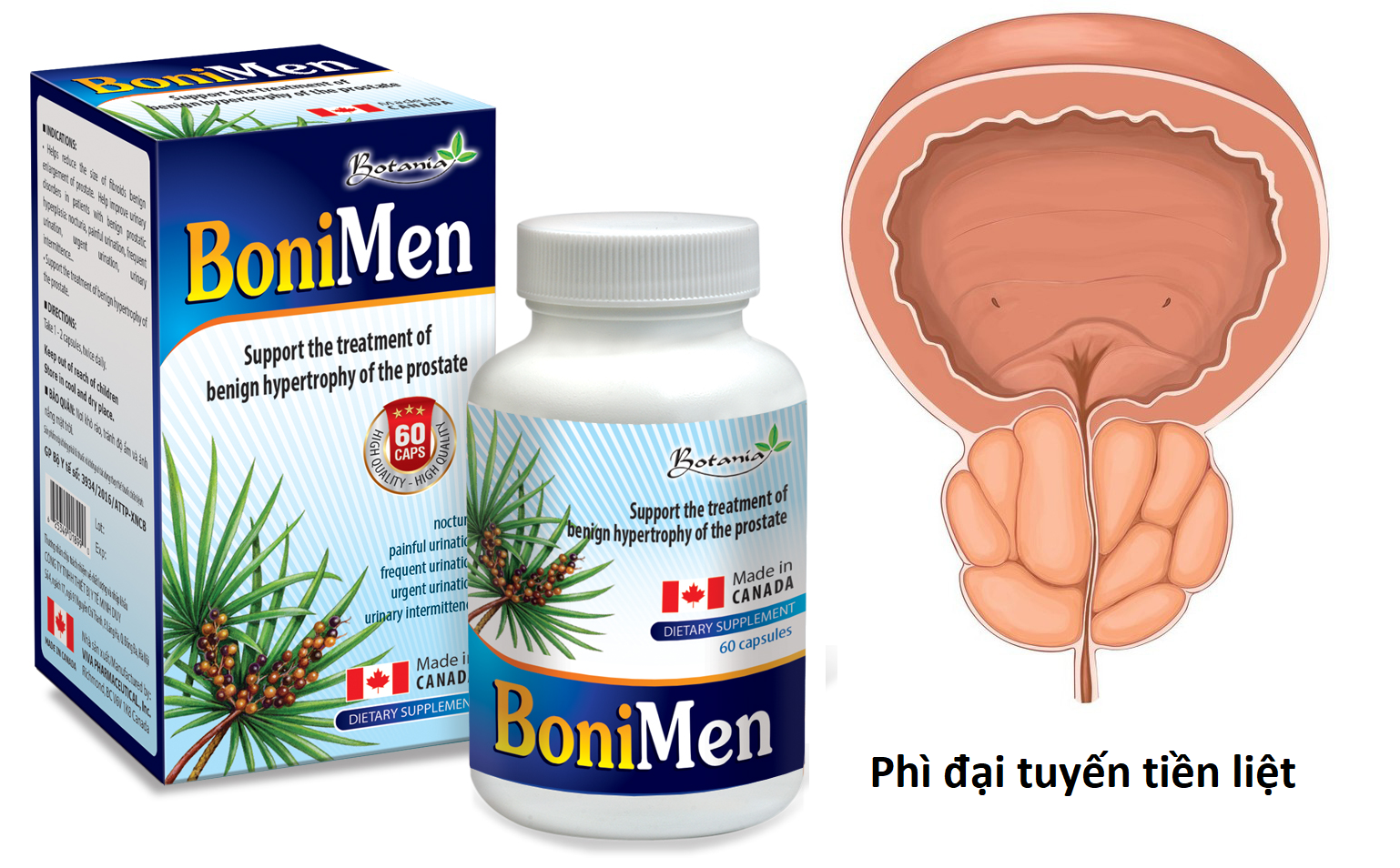 Sản phẩm BoniMen dành cho bệnh phì đại tuyến tiền liệt