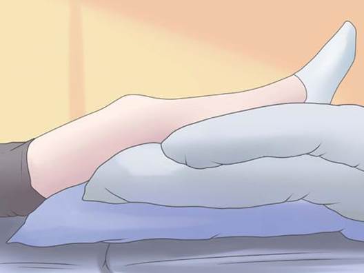 Ngủ kê cao chân cũng là cách đơn giản để giảm đau giãn tĩnh mạch