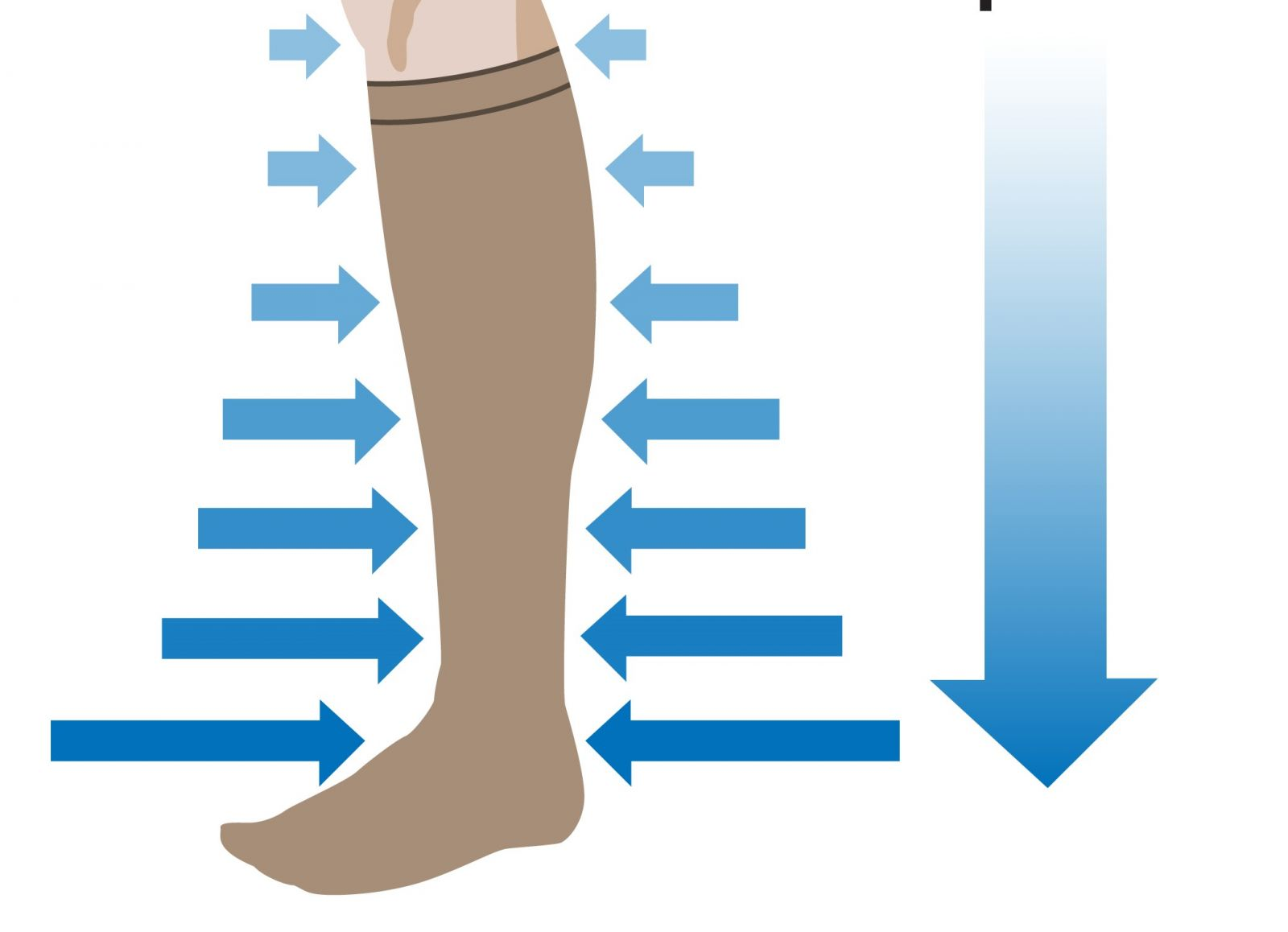 Người bệnh suy giãn tĩnh mạch chân có thể sử dụng vớ ép y khoa