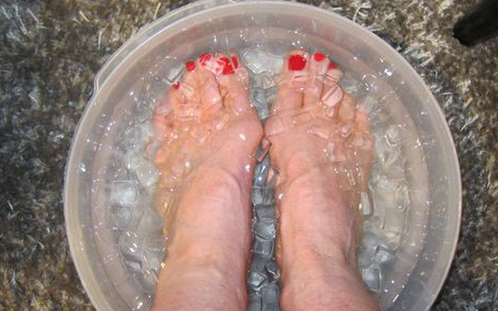 Người bệnh suy giãn tĩnh mạch nên ngâm chân bằng nước lạnh