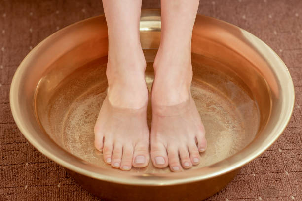 Suy giãn tĩnh mạch không nên ngâm chân nước nóng