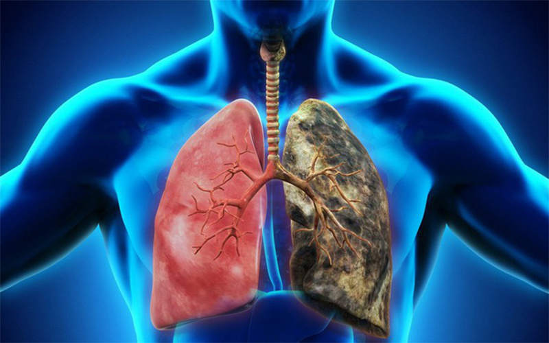Khói thuốc làm tăng nguy cơ mắc ung thư phổi của bạn và những thân